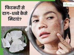 चेहरे के दाग-धब्बे मिटाने के लिए फिटकरी कैसे लगाएं? जानें 5 तरीके, जिनसे डार्क स्पॉट्स से मिलेगा छुटकारा