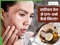 चेहरे के दाग-धब्बे मिटाने के लिए नारियल का तेल कैसे लगाएं? जानें 5 तरीके, जिनसे कम हो जाएंगे डार्क स्पॉट्स