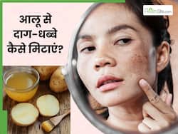 चेहरे के दाग-धब्बे मिटाने के लिए आलू कैसे लगाएं? जानें 5 तरीके, जिनसे डार्क स्पॉट्स से मिलेगा छुटकारा