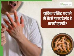 जोड़ों में जमा यूरिक एसिड को बाहर निकाल देगी कच्ची हल्दी, जानें सेवन का सही तरीका