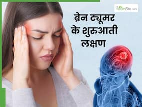 ब्रेन ट्यूमर के शुरुआती स्टेज में दिखाई देते हैं ये 5 लक्षण, दिखते ही भागें डॉक्टर के पास
