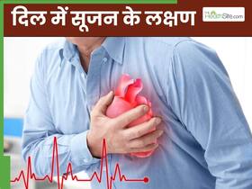 दिल में सूजन होने पर शरीर में नजर आते हैं ये 5 लक्षण, दिखते ही तुरंत भागें डॉक्टर के पास