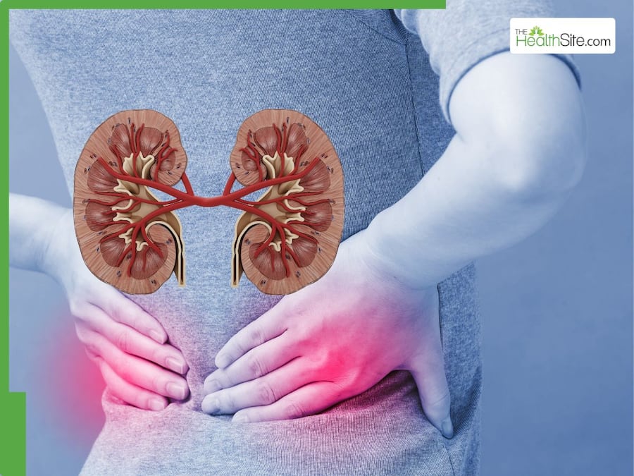 From Silent Damage to the Dialysis Dread: 7 Common Misconceptions About Kidney Disease From Silent Damage to the Dialysis Dread: 7 Common Misconceptions About Kidney Disease