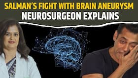 Salman Khan s Shocking Health Reveal: What Is Brain Aneurysm and Trigeminal Neuralgia? Salman Khan s Shocking Health Reveal: What Is Brain Aneurysm and Trigeminal Neuralgia?