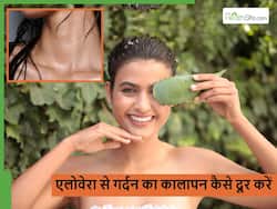 गर्दन पर इस तरह एलोवेरा लगाने से हट जाएगा सारा कालापन, बस जान लें इस्तेमाल का सही तरीका