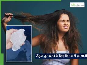 डैंड्रफ और खुजली को जड़ से दूर करता है फिटकरी का पानी, बालों का झड़ना भी होगा कम