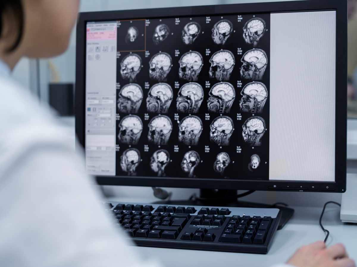 brain tumor, Brain Tumor Prevention, Brain Tumor Symptoms, brain changes, Brain health, treatment for brain tumor, early detection of brain tumor, brain tumor signs, brain tumor symptoms, brain tumor complications