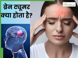 ब्रेन ट्यूमर क्या होता है? जानें इस बीमारी के लक्षण, कारण और इलाज के विकल्प