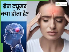 ब्रेन ट्यूमर क्या होता है? जानें इस बीमारी के लक्षण, कारण और इलाज के विकल्प