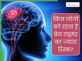 किन लोगों को रहता है ब्रेन ट्यूमर का ज्यादा खतरा? डॉक्टर से जानें