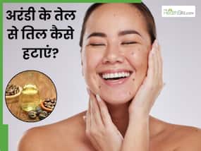अरंडी के तेल से तिल कैसे हटाएं? जानें 5 तरीके, जिनसे मिट जाएंगे तिल और मस्से