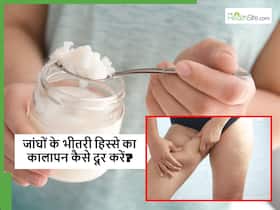 जांघों के बीच का कालापन कैसे दूर करे, बिना किसी महंगी क्रीम के घर पर रखी ये 5 चीजें लगाने से हो जाएगा काम