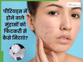 पीरियड्स में हो जाते हैं मुंहासे? तो इन 5 तरीकों से लगाएं फिटकरी, दाग-धब्बों से भी मिल जाएगा छुटकारा पीरियड्स में हो जाते हैं मुंहासे? तो इन 5 तरीकों से लगाएं फिटकरी, दाग-धब्बों से भी मिल जाएगा छुटकारा