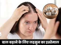 बालों के लिए 1 छोटी सी कली है बहुत फायदेमंद, सिर पर उगा देगी बालों की खेती