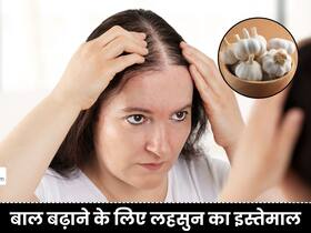 बालों के लिए 1 छोटी सी कली है बहुत फायदेमंद, सिर पर उगा देगी बालों की खेती बालों के लिए 1 छोटी सी कली है बहुत फायदेमंद, सिर पर उगा देगी बालों की खेती
