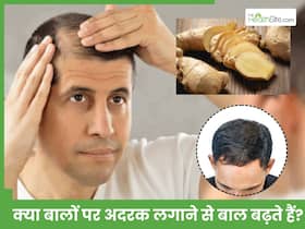 अदरक का एक टुकड़ा बना गंजी खोपड़ी पर ला देगा बाल, सिर पर होगी बालों की लंबी-घनी खेती अदरक का एक टुकड़ा बना गंजी खोपड़ी पर ला देगा बाल, सिर पर होगी बालों की लंबी-घनी खेती