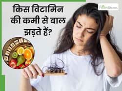 शरीर में इन विटामिन्स की कमी से झड़ते हैं बाल, डाइट में जरूर फॉलो करें ये फूड्स