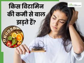 शरीर में इन विटामिन्स की कमी से झड़ते हैं बाल, डाइट में जरूर फॉलो करें ये फूड्स