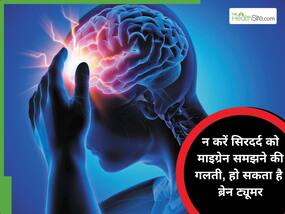 माइग्रेन से मिलता-जुलता होता है ​ब्रेन ट्यूमर का सिर दर्द, सिर के इस हिस्से से होती है दर्द की शुरुआत