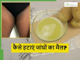 जांघों के बीच का कालापन कैसे दूर करें? आपके घर में रखी इस खास चीज से मिलेगी स्मूद और चिकनी स्किन