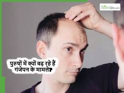 महिलाओं की तुलना में पुरुषों में क्यों तेजी से हो रहा गंजापन और क्या इसका कोई संभव इलाज है? एक्सपर्ट्स से जानें