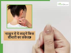 नाखूनों में ऐसी लाइनें दिखना कहीं शरीर में किसी चीज की कमी तो नहीं? जानें कौन सी लाइन देती है किस चीज का संकेत