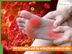 पैरों में दिखने वाले ये 5 लक्षण कहीं Bad Cholesterol का संकेत तो नहीं, कभी भी बढ़ सकता है हार्ट अटैक का खतरा