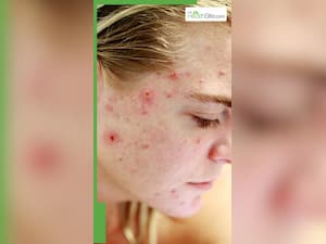 6 Morning Skincare Mistakes You Are Unknowingly Making