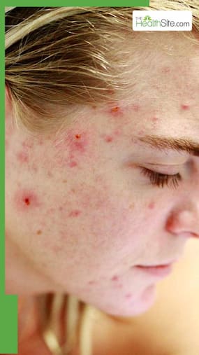 6 Morning Skincare Mistakes You Are Unknowingly Making