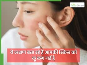 Lu Lagne Ke Lakshan| लू लगने से चेहरे पर दिखाई देते हैं 3 लक्षण, भरी गर्मी में बाहर निकलें तो इन बातों का रखें ध्यान