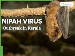 Nipah Virus Outbreak in India: 38-Year-Old Woman Critical, Kerala on High Alert After New Confirmed Cases and One Death