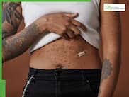 7 Simple Ways To Get Rid Of Body Acne