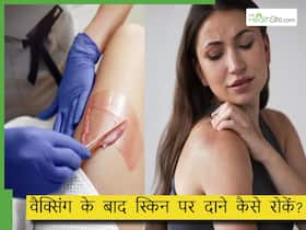 वैक्सिंग करने के बाद स्किन पर निकल आते हैं दाने तो करें ये 5 उपाय, इरिटेशन और रैशेज से भी मिलेगा आराम