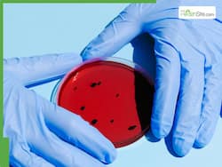 Chikungunya Outbreak Grips Southern China   s Foshan City, 2,658 Confirmed Cases Reported