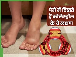 कोलेस्ट्रॉल बढ़ने पर पैरों के आसपास दिखाई देते हैं ये 4 लक्षण, नजरअंदाज करने की न करें भूल