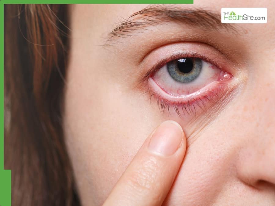 Fizer -Biontech's Covid -19 vaccine side effects: What does a thick cornea and low cell density mean?