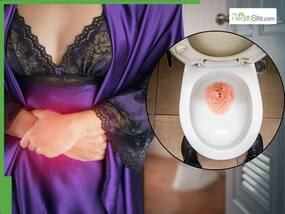 Diabetes Symptoms: 10 Surprising Signs of High Blood Sugar That Appear In Your Urine