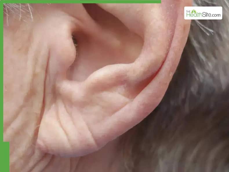 thehealthsite.com top news