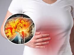 Fatty Liver Side Effects: Warning Signs in Your Hands That Could Reveal Hidden Liver Issues