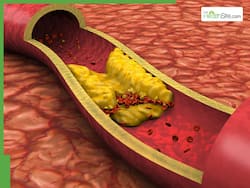 5 Everyday Habits That Raise Your Cholesterol And How To Break Them