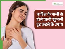 बारिश में भीगने के बाद खुजली से हैं परेशान तो आजमाएं ये 5 घरेलू उपाय, तुरंत मिलेगी राहत