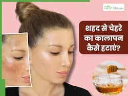 शहद से चेहरे का कालापन कैसे हटाएं? जानें 5 तरीके, जिनसे साफ होंगे दाग-धब्बे और निखर जाएगी त्वचा