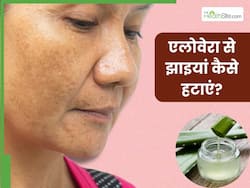 एलोवेरा से चेहरे की झाइयां कैसे हटाएं? जानें 5 तरीके, जिनसे मिट जाएंगे सारे दाग-धब्बे