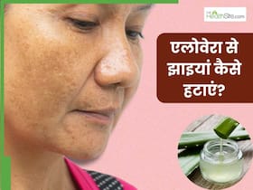 एलोवेरा से चेहरे की झाइयां कैसे हटाएं? जानें 5 तरीके, जिनसे मिट जाएंगे सारे दाग-धब्बे