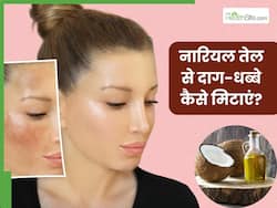 दाग-धब्बे मिटाने के लिए चेहरे पर नारियल तेल कैसे लगाएं? जानें 5 तरीके, जिनसे डार्क स्पॉट्स से मिलेगा छुटकारा