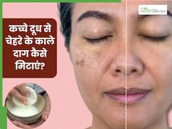 चेहरे के काले दाग हटाने के लिए कच्चा दूध कैसे लगाएं? जानें 5 तरीके, जिनसे मिट जाएंगे जिद्दी दाग-धब्बे