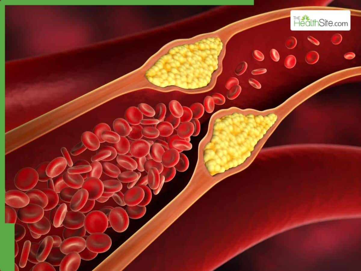 Top 5 Cholesterol-Fighting Seeds You Can Add To Your Diet Today