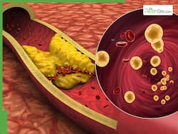 LDL And HDL: How The Two Types Of Cholesterol Are Different From Each Other