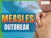 Measles Outbreak LIVE Updates: US Surpassed 1,100 Fresh Cases In Two Months - Expect More Deaths Next, Says Officials