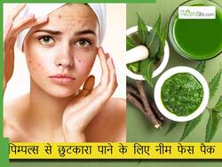 पिम्पल्स कम करने के लिए चेहरे पर नीम कैसे लगाएं? इन 5 तरीकों से फेस पर यूज़ करें नीम, स्किन बनेगी हेल्दी